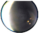 kosch1.tif