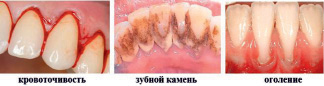 bayml4.tif